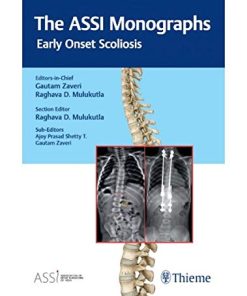 The ASSI Monographs: Early Onset Scoliosis (PDF)