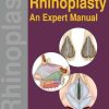 Rhinoplasty: An Expert Manual (PDF)