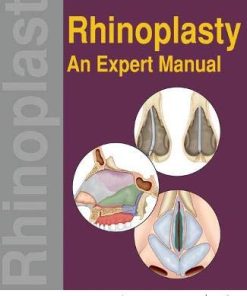 Rhinoplasty: An Expert Manual (PDF)