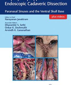 Step By Step Approach To Endoscopic Cadaveric Dissection Paranasal Sinuses And The Ventral Skull Base (PDF Book+Videos)