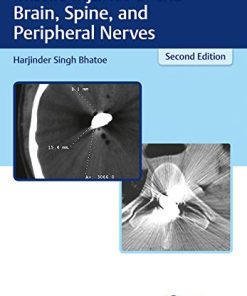 Missile Injuries Of The Brain Spine And Peripheral Nerves, 2nd edition (PDF)