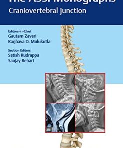 The ASSI Monographs-Craniovertebral Junction (PDF)