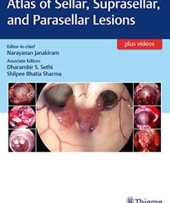 Atlas of Sellar, Suprasellar, and Parasellar Lesions (PDF Book+Videos)