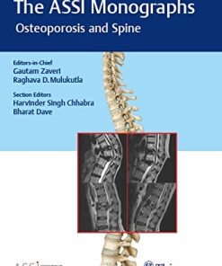 The ASSI Monographs – Osteoporosis and Spine (PDF)