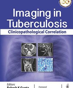 Imaging in Tuberculosis: Clinicopathological Correlation (PDF)