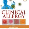 Clinical Allergy (PDF)
