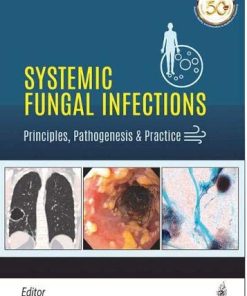 Systemic Fungal Infections: Principles, Pathogenesis & Practice (PDF)