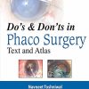 Do’s & Dont’s in Phaco Surgery: Text and Atlas (PDF)