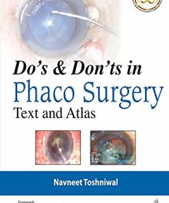 Do’s & Dont’s in Phaco Surgery: Text and Atlas (PDF)