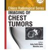 Clinico Radiological Series: Imaging of Chest Tumors (PDF)