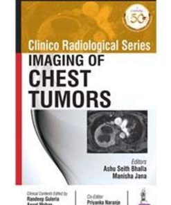 Clinico Radiological Series: Imaging of Chest Tumors (PDF)