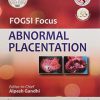 FOGSI Focus Abnormal Placentation (PDF)