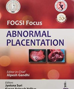 FOGSI Focus Abnormal Placentation (PDF)