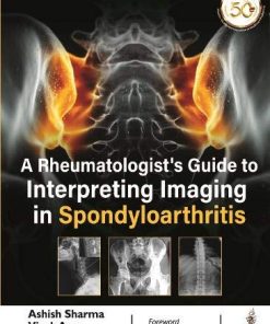 A Rheumatologist’s Guide to Interpreting Imaging in Spondyloarthritis (PDF)