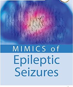 Mimics Of Epileptic Seizures (PDF)