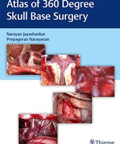 Atlas of 360 degrees Skull Base Surgery (PDF)