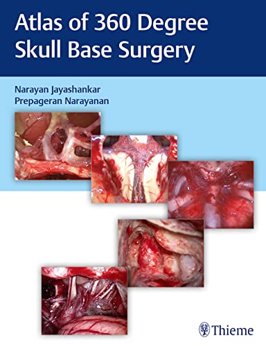 Atlas of 360 degrees Skull Base Surgery (PDF) Atlas of 360 degrees Skull Base Surgery (PDF)