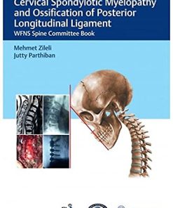 Cervical Spondylotic Myelopathy and Ossification of Posterior Longitudinal Ligament (PDF)