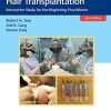 Practical Guide to Hair Transplantation: Interactive Study for the Beginning Practitioner (PDF Book+Videos)