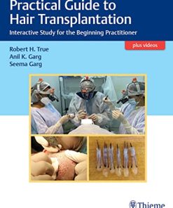 Practical Guide to Hair Transplantation: Interactive Study for the Beginning Practitioner (PDF Book+Videos)