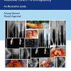 Computer Navigated and Handheld Robotic Knee Arthroplasty: An Illustrative Guide (PDF)