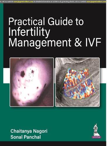 Practical Guide to Infertility Management & IVF (PDF) Practical Guide to Infertility Management & IVF (PDF)