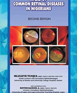 The Atlas of Retinal Diseases in Nigerians (PDF)