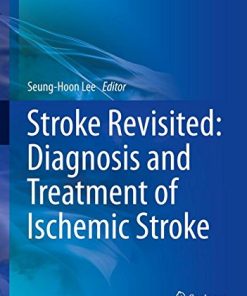 Stroke Revisited: Diagnosis and Treatment of Ischemic Stroke (PDF)