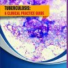 Tuberculosis: a clinical practice guide (PDF)