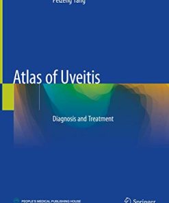 Atlas of Uveitis: Diagnosis and Treatment (PDF)