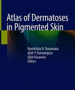 Atlas of Dermatoses in Pigmented Skin (PDF)