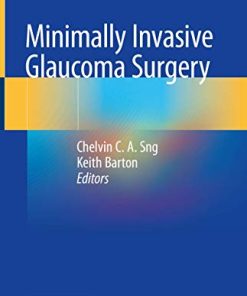 Minimally Invasive Glaucoma Surgery (PDF)