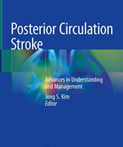 Posterior Circulation Stroke: Advances in Understanding and Management (PDF)