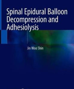 Spinal Epidural Balloon Decompression and Adhesiolysis (PDF)