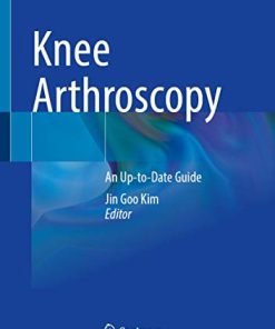 Knee Arthroscopy: An Up-to-Date Guide (PDF)