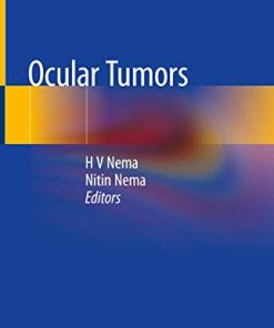 Ocular Tumors (PDF)