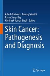 Skin Cancer: Pathogenesis and Diagnosis (PDF)