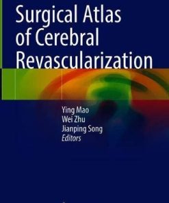 Surgical Atlas of Cerebral Revascularization (PDF)