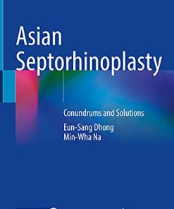 Asian Septorhinoplasty: Conundrums and Solutions (PDF)