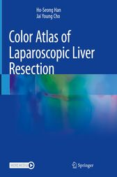 Color Atlas of Laparoscopic Liver Resection (PDF)