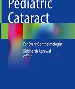 Pediatric Cataract: For Every Ophthalmologist (PDF)