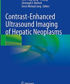 Contrast-Enhanced Ultrasound Imaging of Hepatic Neoplasms (PDF)