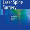 Laser Spine Surgery (PDF)