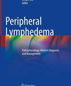 Peripheral Lymphedema: Pathophysiology, Modern Diagnosis and Management (PDF)