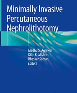 Minimally Invasive Percutaneous Nephrolithotomy (PDF)