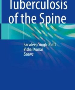 Tuberculosis of the Spine (PDF)