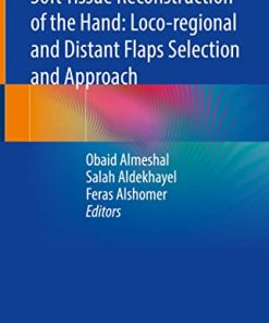 Soft Tissue Reconstruction of the Hand: Loco-regional and Distant Flaps Selection and Approach (PDF)