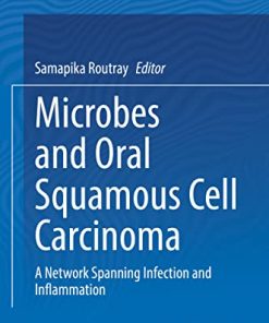 Microbes and Oral Squamous Cell Carcinoma: A Network Spanning Infection and Inflammation (PDF)