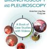 Interventional Bronchoscopy and Pleuroscopy: A Book of Case Studies With Videos (PDF)