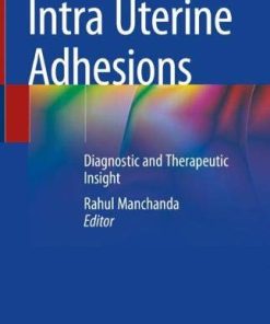 Intra Uterine Adhesions: Diagnostic and Therapeutic Insight (PDF)